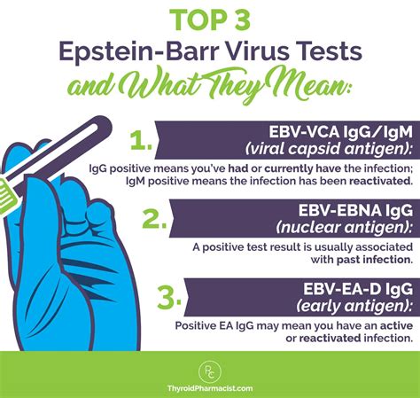epstein barr virus test